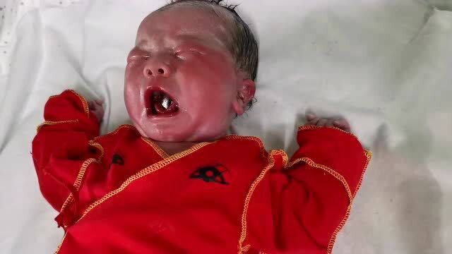 刚出生的宝宝一身红,难道这就是传说中的红孩儿,饿的一直哭停不下来