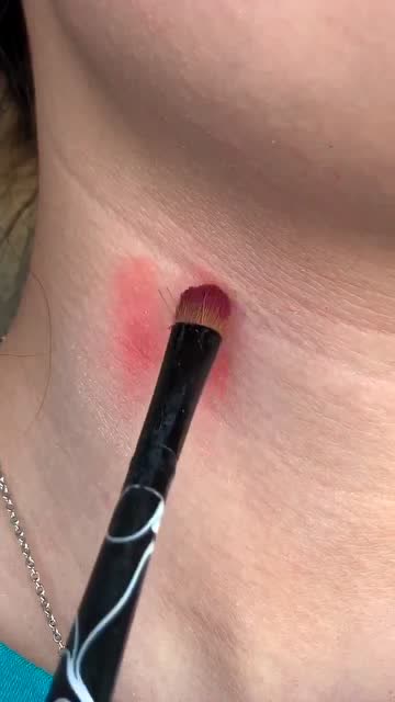 前男友吸的草莓印我到底该怎么办