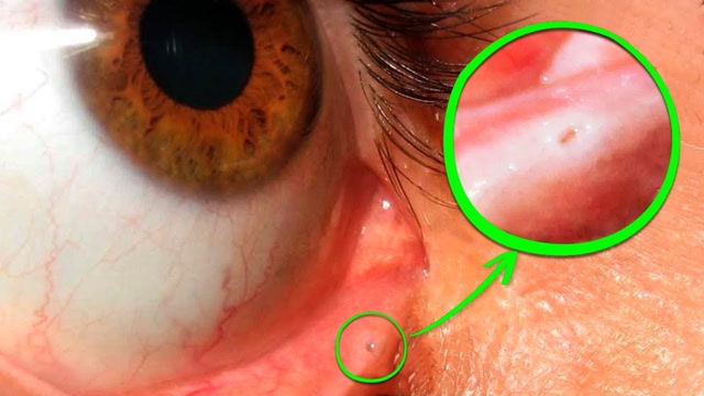 8件你不知道的事,你知道眼睛里面的小洞是干什么的吗?