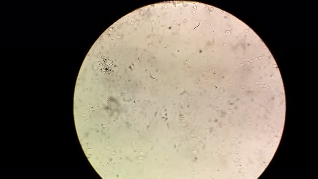 高倍显微镜下,鸡血红细胞被吞噬细胞所追杀,大自然真神奇