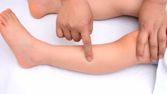 艾灸丰隆穴(陶瓷灸)