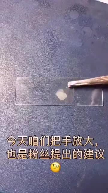 手里的细菌放大1000倍非常时期勤洗手有好处