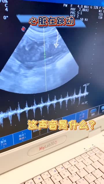 小猫还在母猫肚子里时的心跳声!小助手小助手猫怀孕