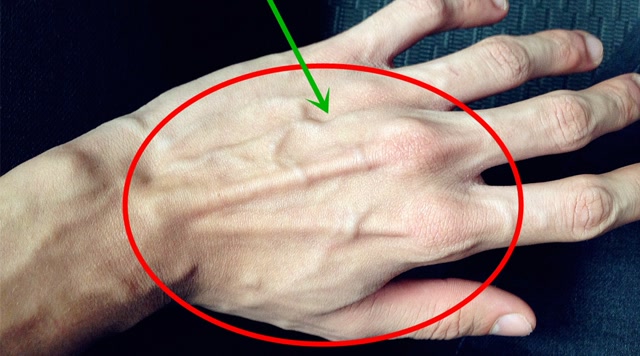 为什么有的人手上青筋特别多,这正常吗?今天可算知道了