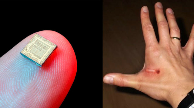 星际时代来了!上万人成功植入人体芯片,手机将被淘汰?