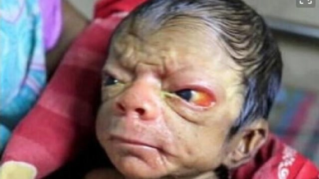 近亲结婚并不会导致畸形儿?澳大利亚教授来告诉你!答案你相信吗