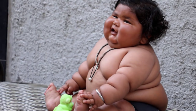 世界上最胖的小女孩,年仅6岁重达181斤,食量却大得惊人