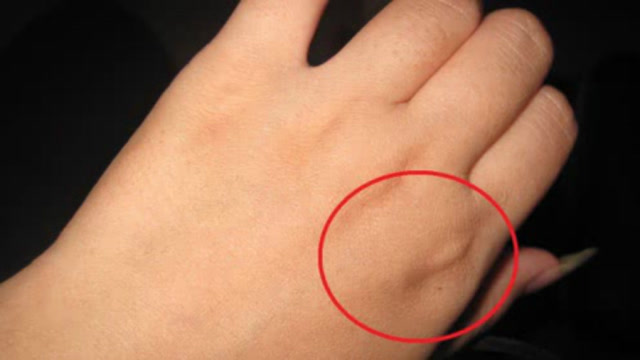 恭喜了!手背上有富贵窝的女人,天生旺夫旺子,你手上有吗?