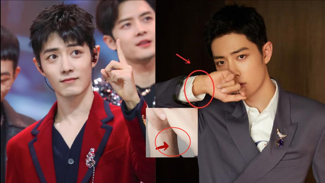 真爷们儿!肖战手腕新增疤痕疑似受伤,曾要求修图师抠掉