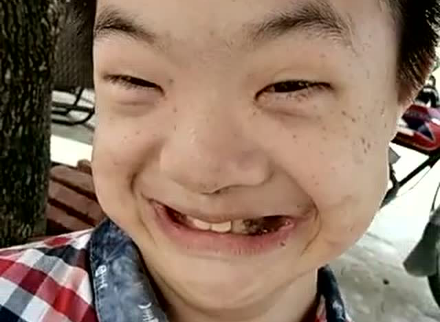 网红鼻涕大王 火遍网络