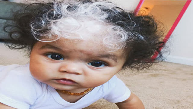 小女孩出生额头自带白发,小模样好特别超可爱