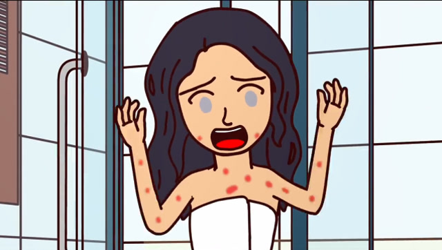 女子对水过敏,一沾水身上就起红疹,她却十分感激这个病?