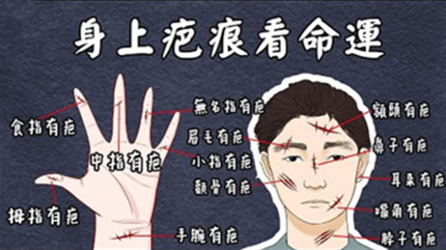 疤痕面相身上此处有疤痕一生苦难多难富贵