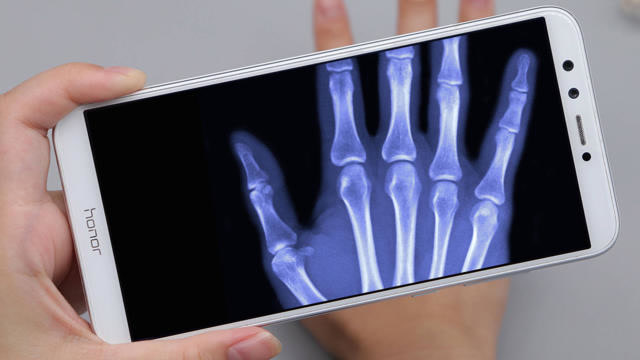 开启手机"透视"功能,像x光一样可以看见手上的骨头,厉害了!