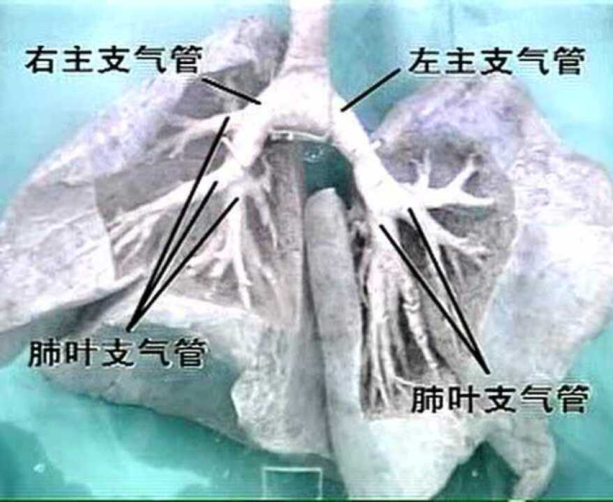 《卫生部医学视听教材》——系统解剖学——呼吸系统解剖_标清_高清