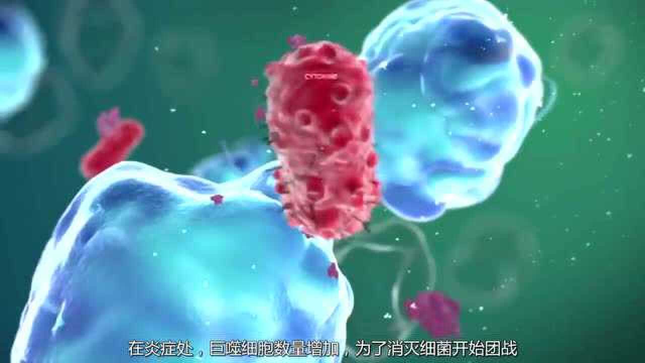 炎症反应和自身免疫病发生原理_高清1080P在线观看平台_腾讯视频