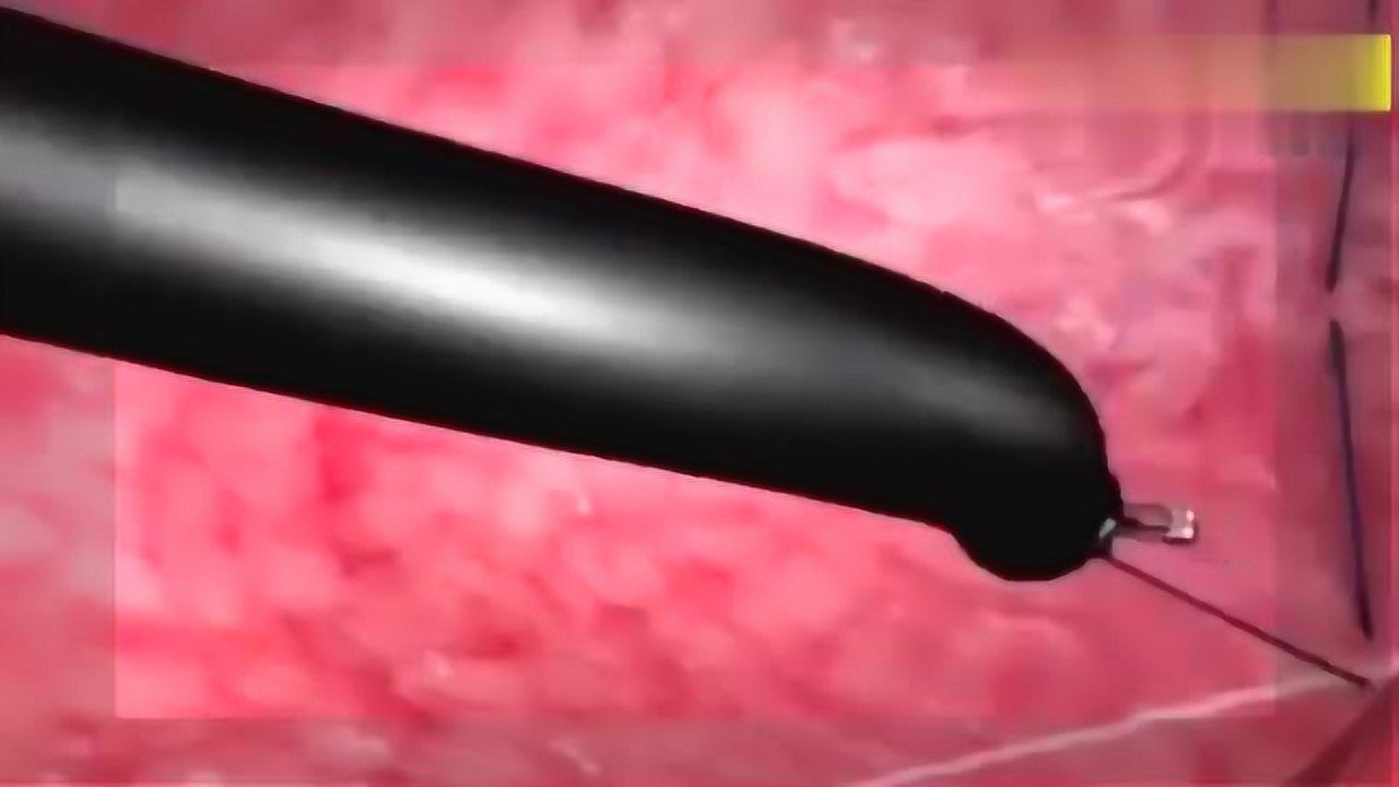 精密的医用内窥镜怎样生产，来看看_高清