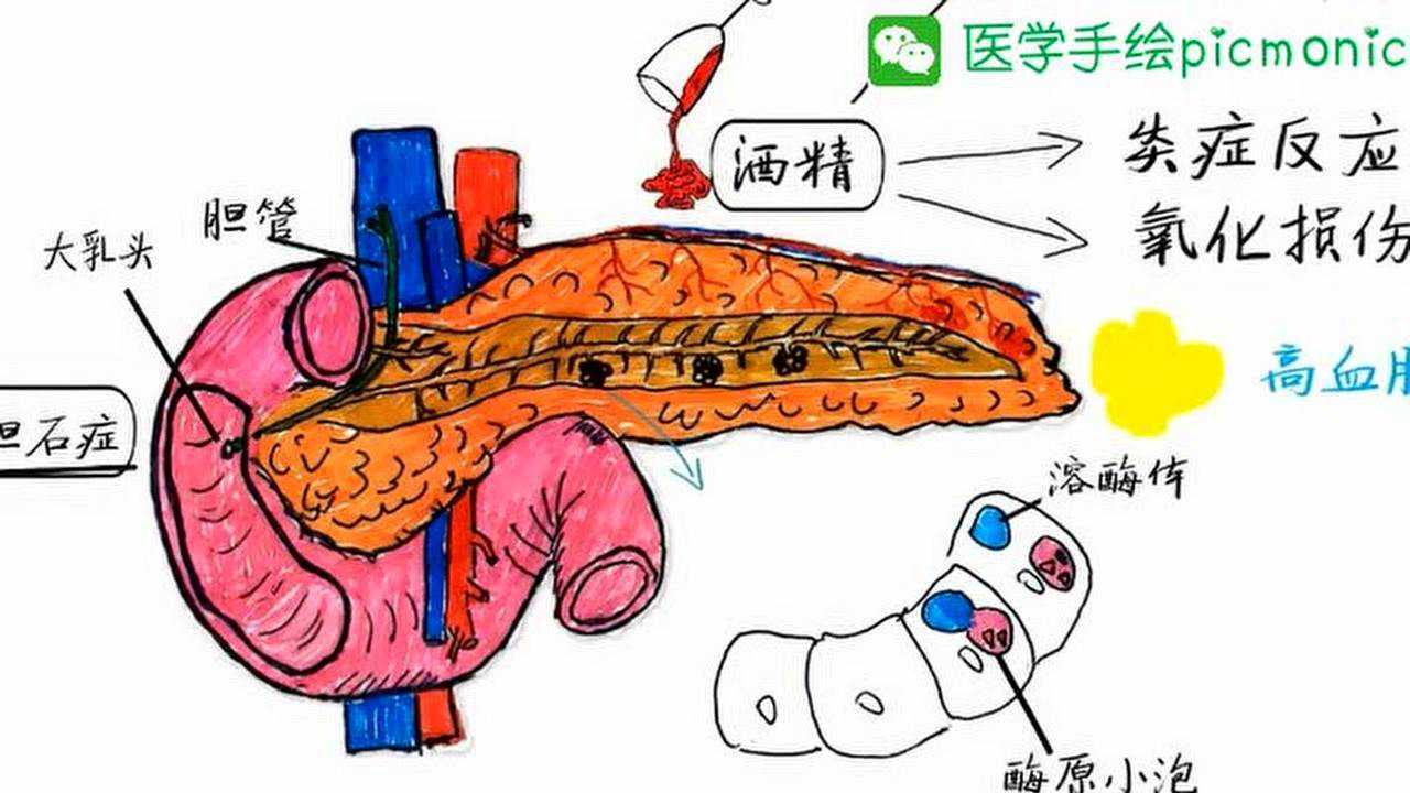急性胰腺炎AP_高清1080P在线观看平台_腾讯视频
