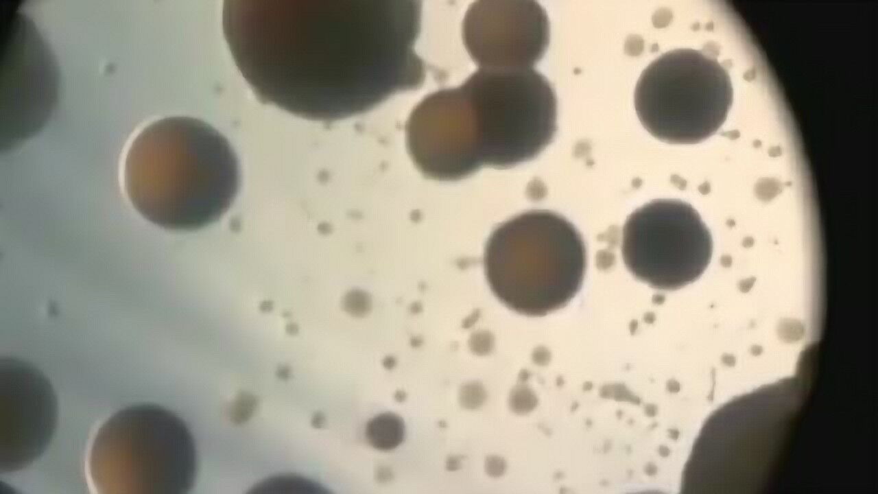 500倍显微镜下看手上的细菌，这个看后都有什么感想？_高清