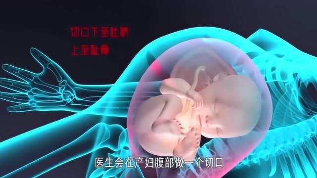 演示剖宫产手术全过程,刨腹产生孩子手术.