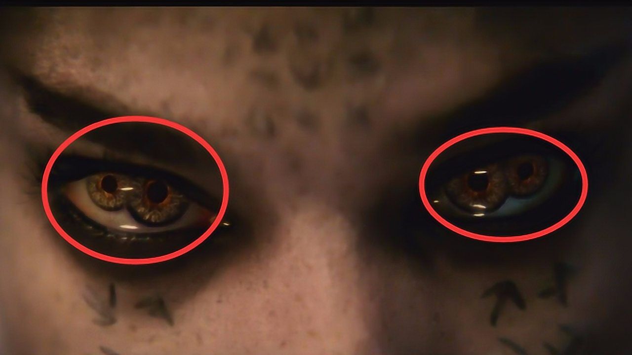 拥有"双瞳孔"的人,他们看到的世界和正常人,有什么不一样?