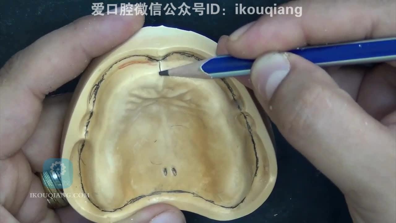 全口义齿之蜡堤制作实拍_腾讯视频