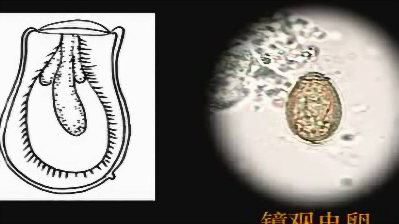 手绘肝吸虫卵_高清1080P在线观看平台_腾讯视频