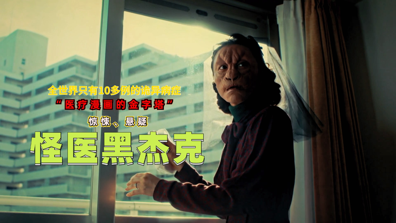 完美还原,直呼"不敢想",真人版《怪医黑杰克》出乎意外的精彩