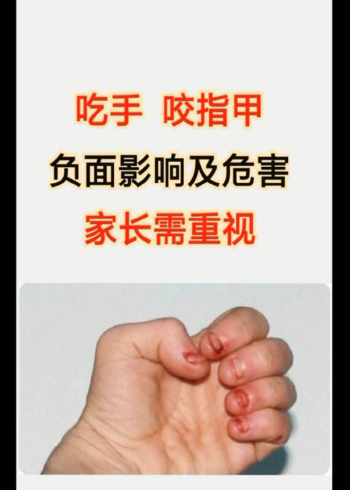 吃手咬指甲负面影响及危害家长需重视