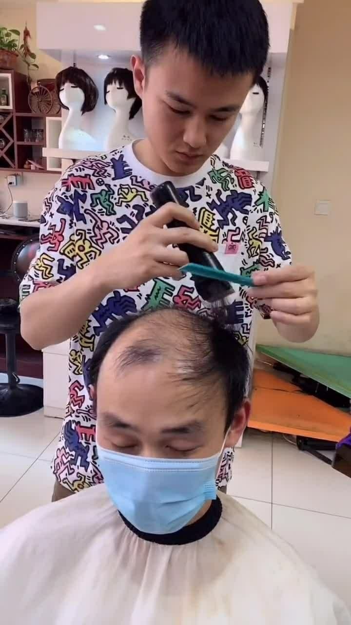 二十多岁的程序员已经成为了秃头