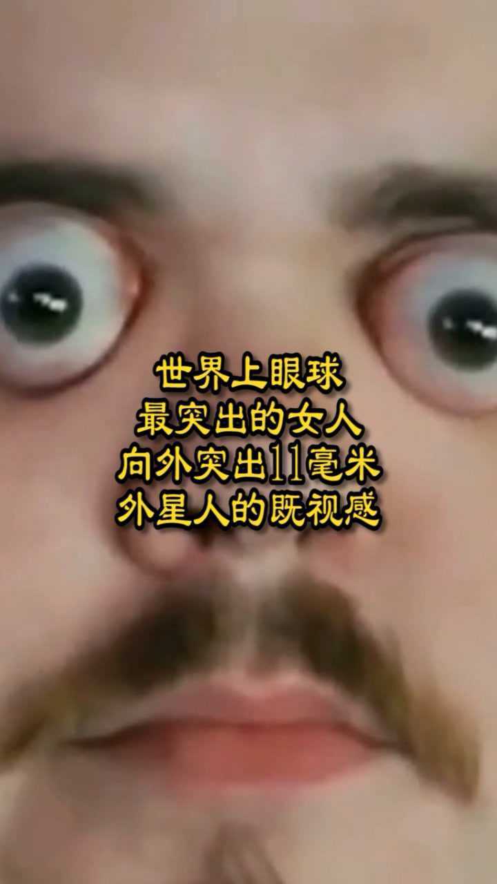 世界上眼球最突出的人向外突出11毫米外星人的既视感