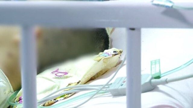 母亲拼命护女被胡蜂蜇伤60处 孩子脏器受损进ICU