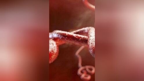 美国食品药品管理局批准全球首个埃博拉病毒治疗方法：银马泽伯