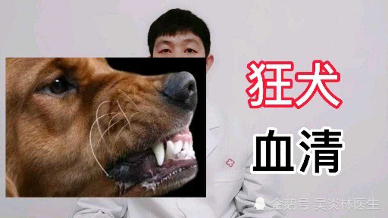 年后第一个班,犬伤门诊忙疯了,医生告诉你狗咬伤第一时间该怎么处理_高清1080P在线观看平台_腾讯视频