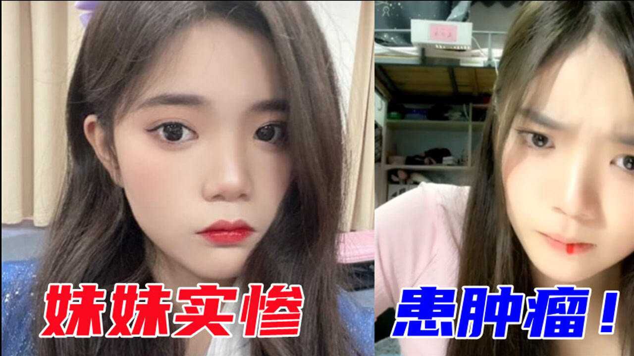 刘丽千直播吐血原因曝光发文称确诊肿瘤表示想放弃治疗