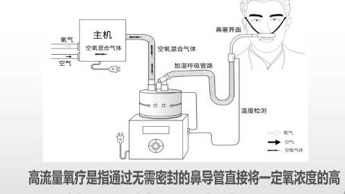 迈瑞sv300呼吸机说明书图片