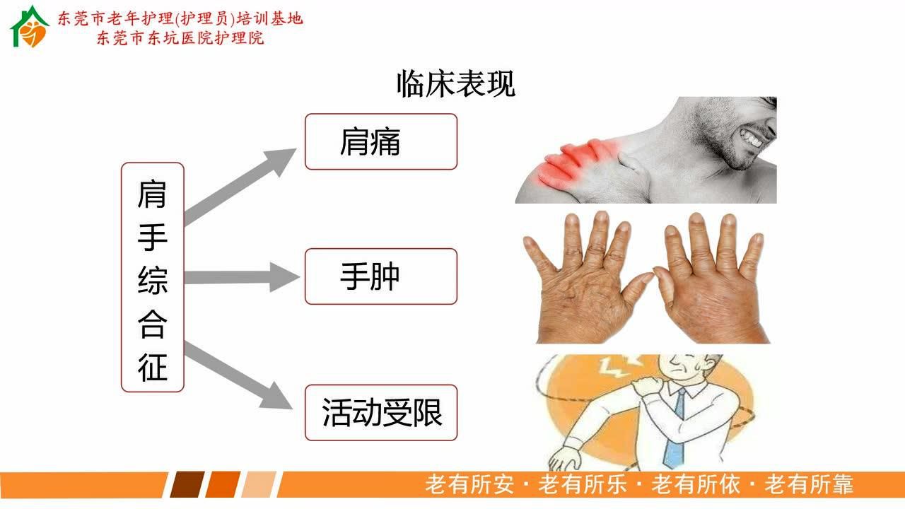 东莞市老年护理基地——肩手综合征的康复锻炼(1潘诗敏)
