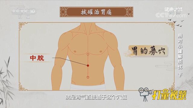 拔罐治胃病从哪方面入手?试试这6个穴位,专家示范