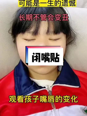 孩子张嘴睡觉一定要注意 久了可是会变丑的哦!#闭嘴贴