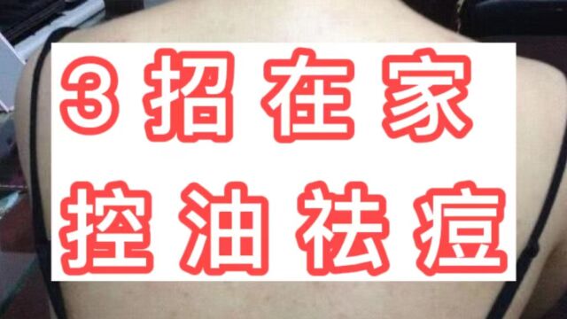 过来人支你3个在家除痘妙招!任意掌握一个,脸上、身上嫩如新!