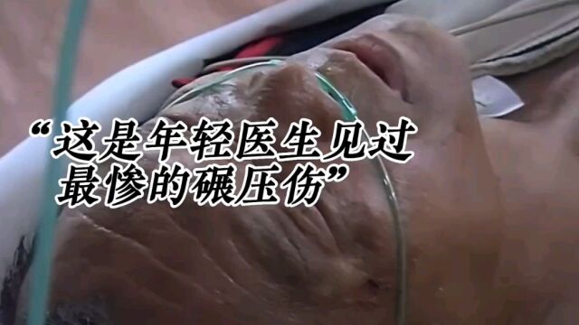 这是年轻医生见过最惨的碾压伤