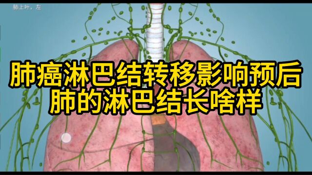 肺癌淋巴结转移影响预后,肺的淋巴结长啥样?外科医生告诉你