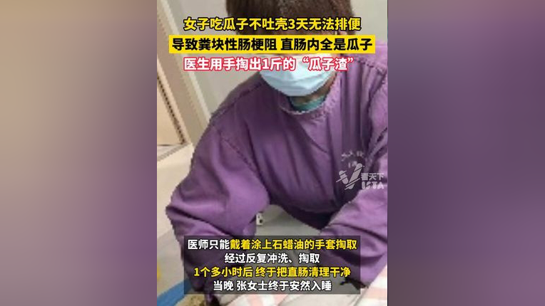 导致粪块性肠梗阻,直肠内全是瓜子,医生用手掏出1斤的"瓜子渣"