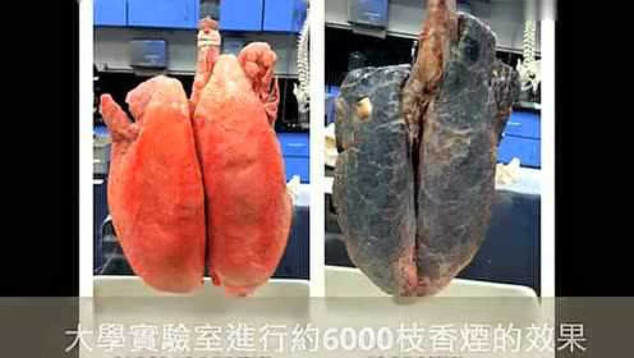 吸烟实验“烟肺”解剖（成品）_高清