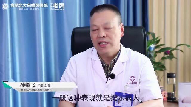 北大主任孙希飞:白癜风初期的表现,早发现,早一些错过病情严重期!