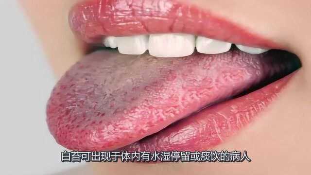 舌头能反映人的身体状况,舌苔厚白是什么原因?教你一招判断体质