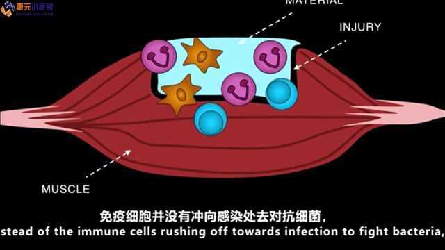 新生物材料诞生!能让伤口更快愈合 还不留疤