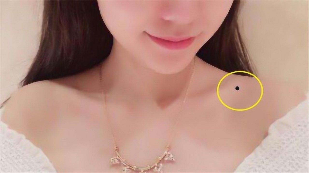 女性身上这3处有痣,注定是大富大贵命,千万别点掉!