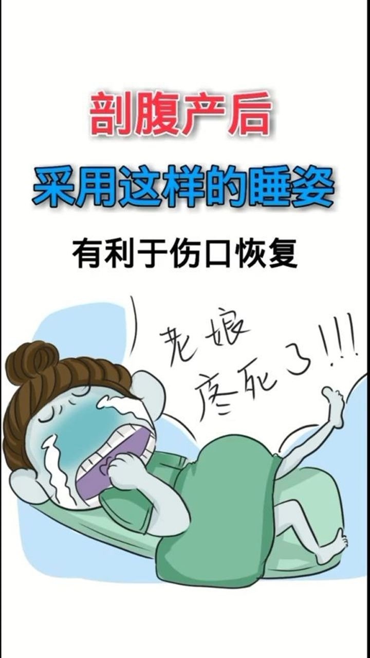 剖腹产后采用这样的睡姿有利于伤口的恢复