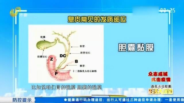 人体黏膜表面的赘生物都是息肉吗?专家给出答复 快来听听